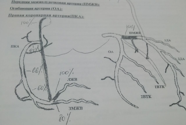 Как я стал живым